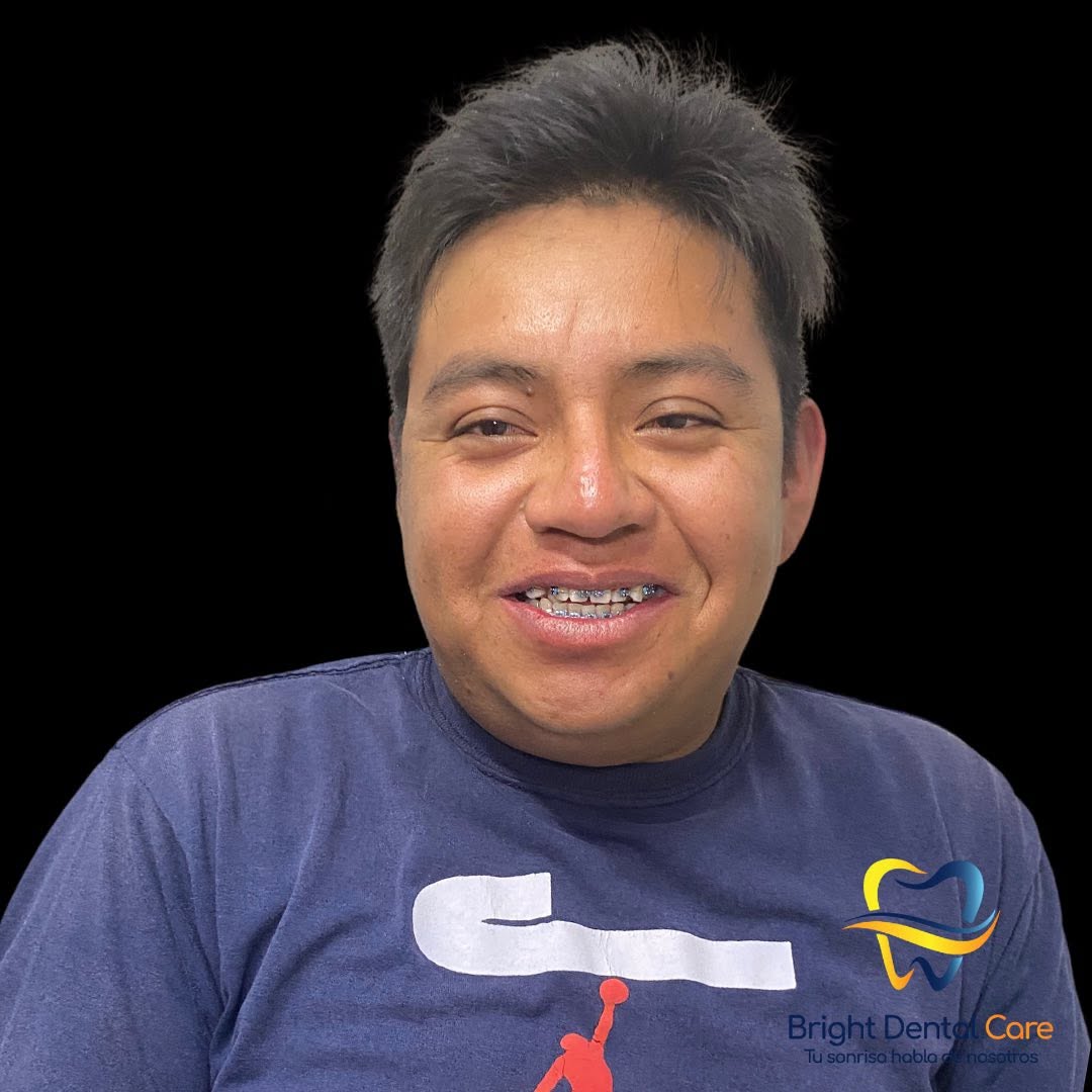 Resultado de tratamiento dental integral en Nogales