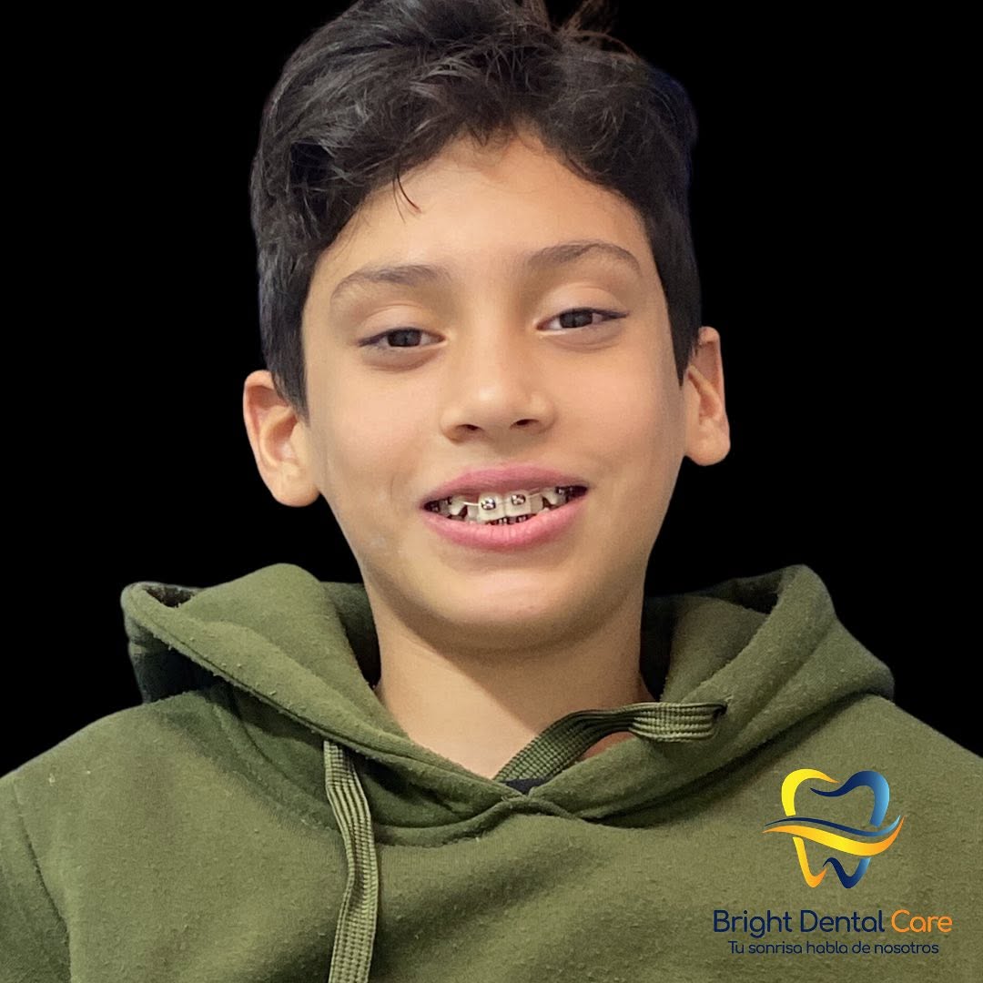 Paciente con sonrisa renovada en Bright Dental Care
