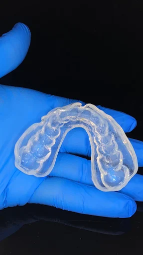 Resultado de tratamiento dental realizado en Bright Dental Care
