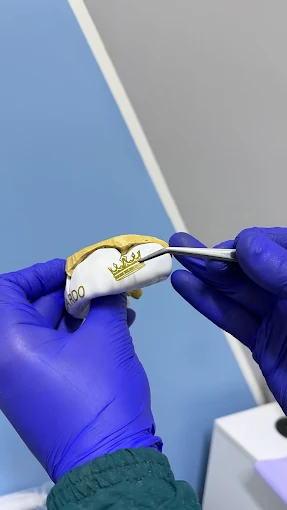 Resultado de tratamiento dental realizado en Bright Dental Care
