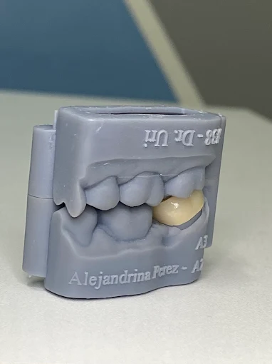 Resultado de tratamiento dental realizado en Bright Dental Care