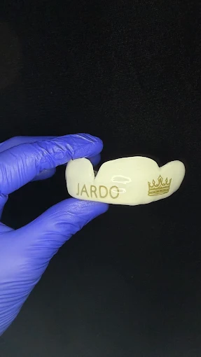 Resultado de tratamiento dental realizado en Bright Dental Care