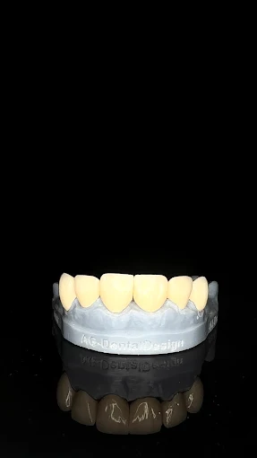 Resultado de tratamiento dental realizado en Bright Dental Care
