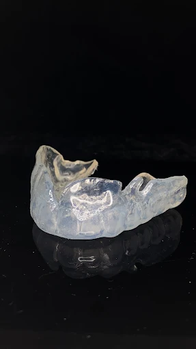 Resultado de tratamiento dental realizado en Bright Dental Care